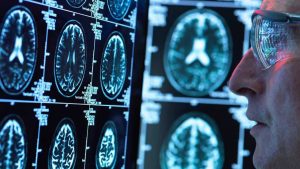 El cerebro bilingüe usa un solo motor gramatical