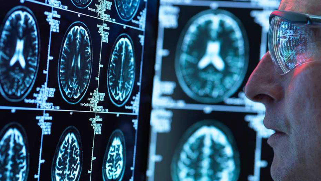 El cerebro bilingüe usa un solo motor gramatical